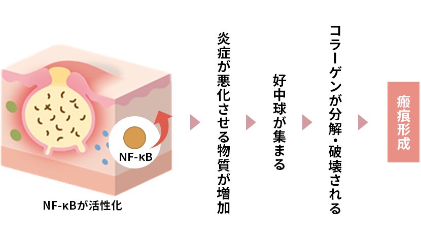 炎症を引き起こす物質が増える