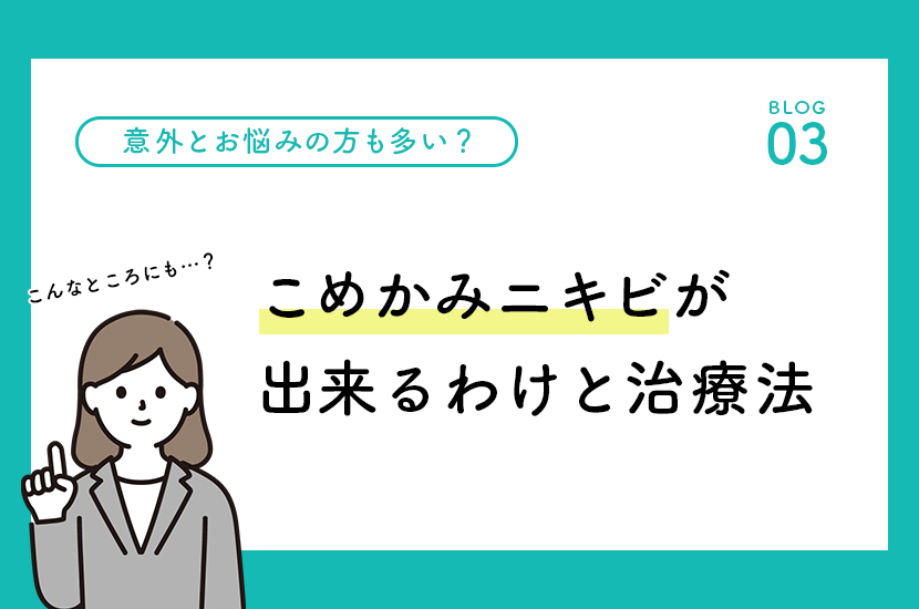 こんなところにも！こめかみニキビが出来るわけと治療法 - 鹿児島・福岡でニキビ治療するならセイコメディカルビューティクリニック