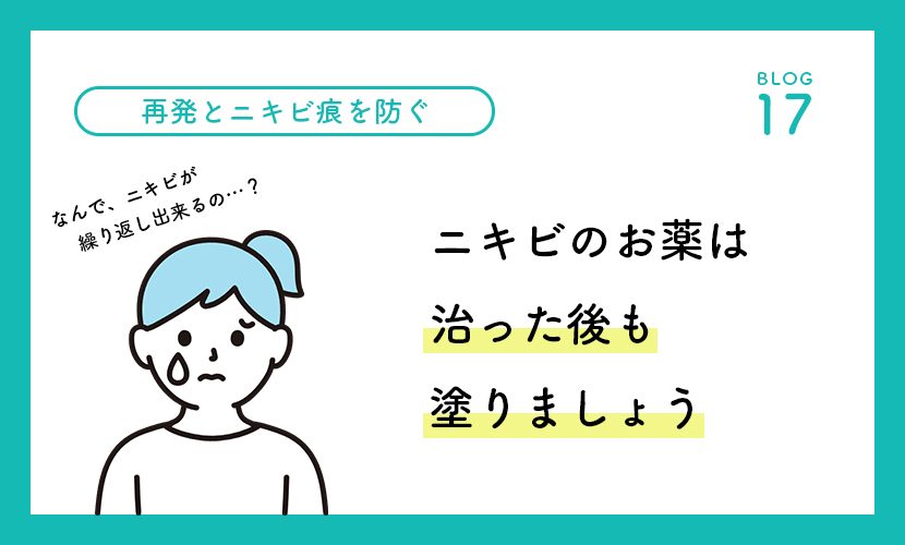 ニキビのお薬は治った後も塗りましょう