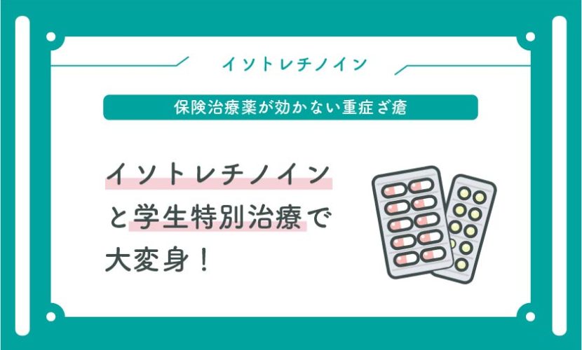 イソトレチノインと学生特別治療で大変身！