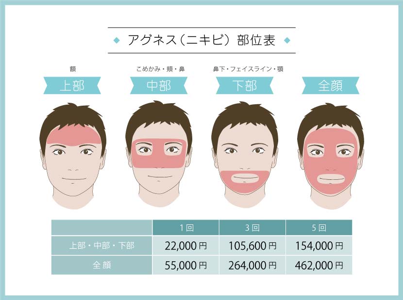 ニキビ治療　アグネス　部位表　料金表