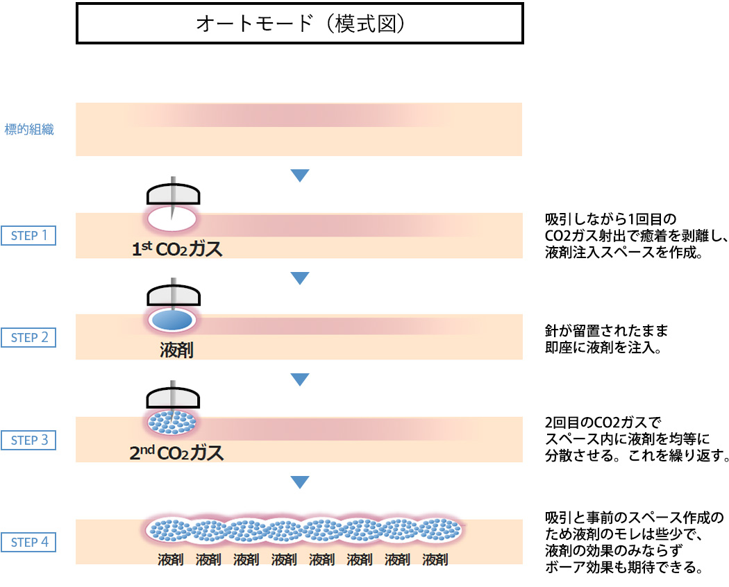 オートインジェクション（模式図）