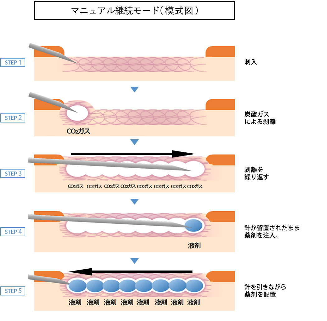 マニュアル継続モード( 模式図 )