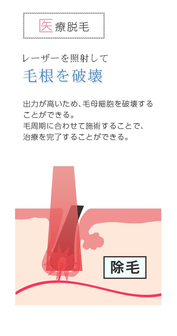 鹿児島 天文館・山形屋さん近く 医療脱毛 | セイコメディカル 鹿児島 天文館・山形屋さん近く 医療脱毛 | セイコメディカル