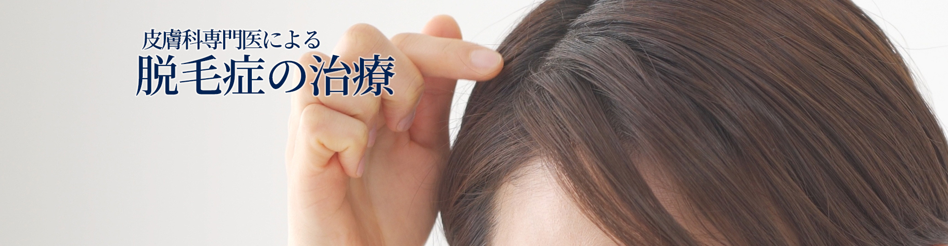 皮膚科専門医による脱毛症の治療
