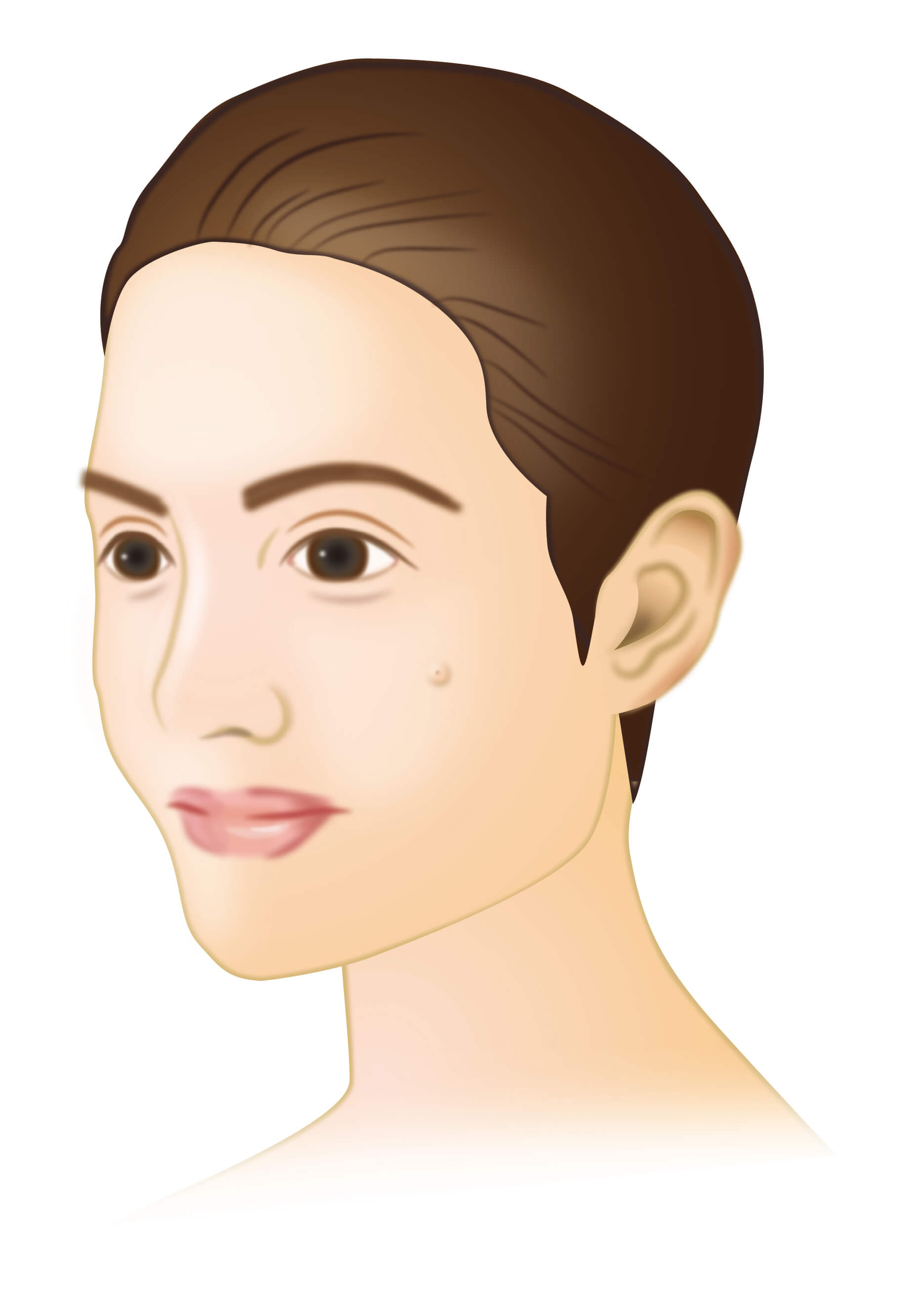 顔にできた粉瘤