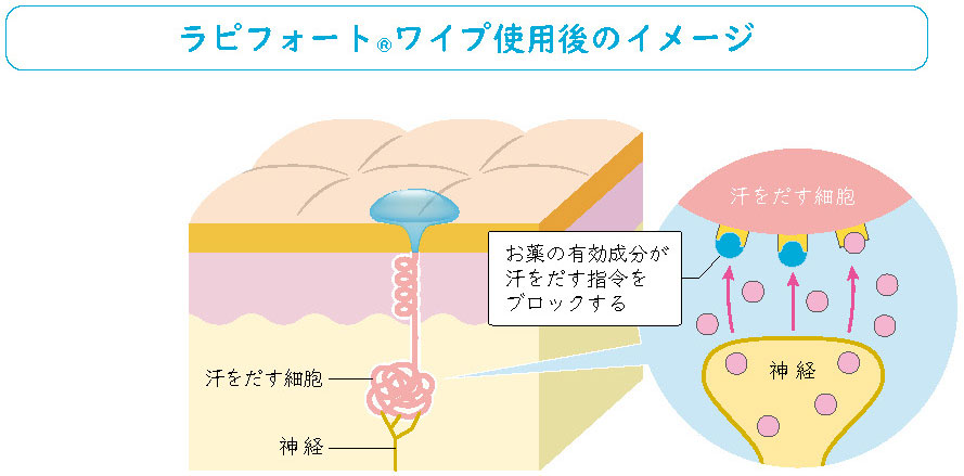 ラピフォートワイプの使用後のイメージ