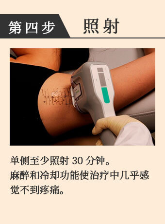 照射 一边至少照射30分钟。麻醉和冷却功能使治疗中几乎感觉不到疼痛。