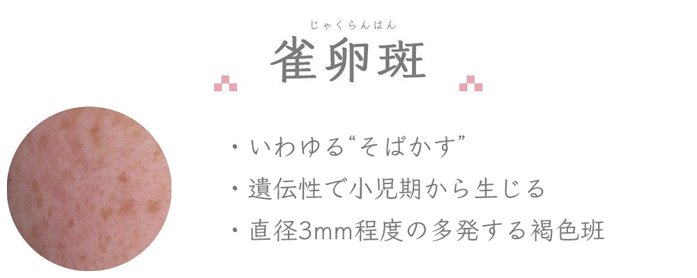 雀卵斑：いわゆる“そばかす”／遺伝性で小児期から生じる／直径3mm程度の多発する褐色班