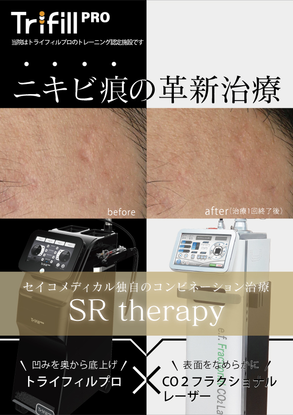 ニキビ痕の革新治療「SRtherapy」はセイコメディカル独自のコンビネーション治療です。