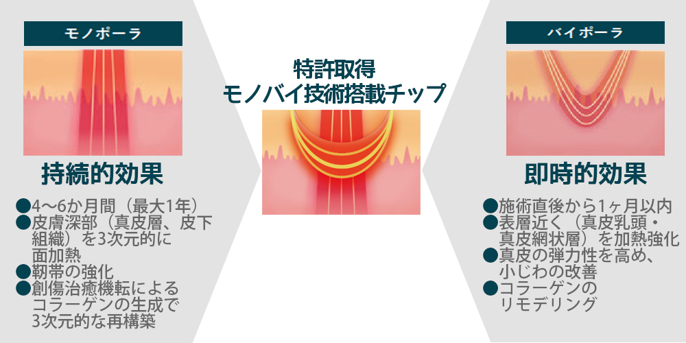 DENSITY　モノバイ技術のここがすごい