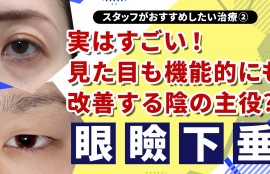 実はすごい！目の見た目も機能にも改善する“陰の主役”眼瞼下垂修正とは？｜スタッフがおすすめしたい治療②　眼瞼下垂修正｜セイコメディカルビューティクリニック