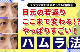 目元の若返り、ここまで変わる！？やっぱりハムラ法がすごい！｜スタッフがおすすめしたい治療③