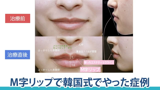 自然にふっくらとした唇