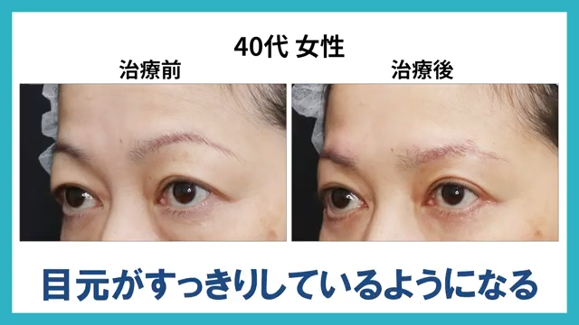 視界改善イメージ