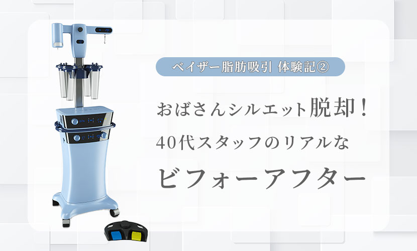 おばさんシルエット脱却！ 40代スタッフのリアルな ビフォーアフター｜ベイザー脂肪吸引体験記②