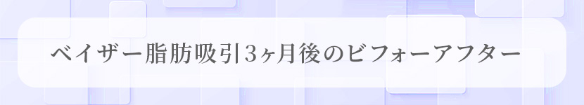 術後のビフォーアフター