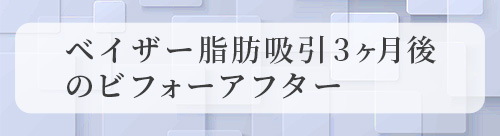 術後のビフォーアフター