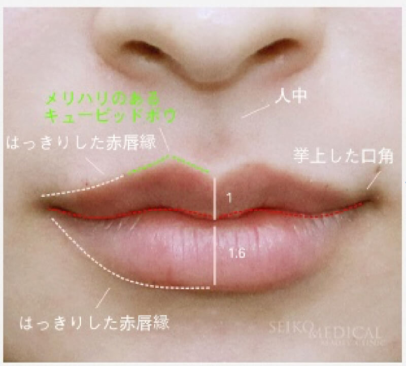 【唇のヒアルロン酸注入】自然な形で、黄金比にボリュームアップしたM字リップの症例解説