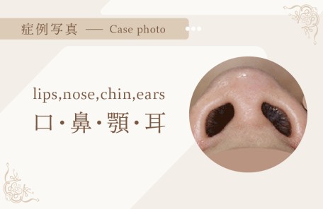 口・鼻・顎・耳 症例写真