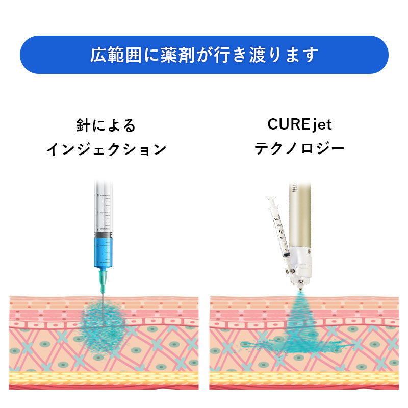 広範囲に薬剤が行き渡ります