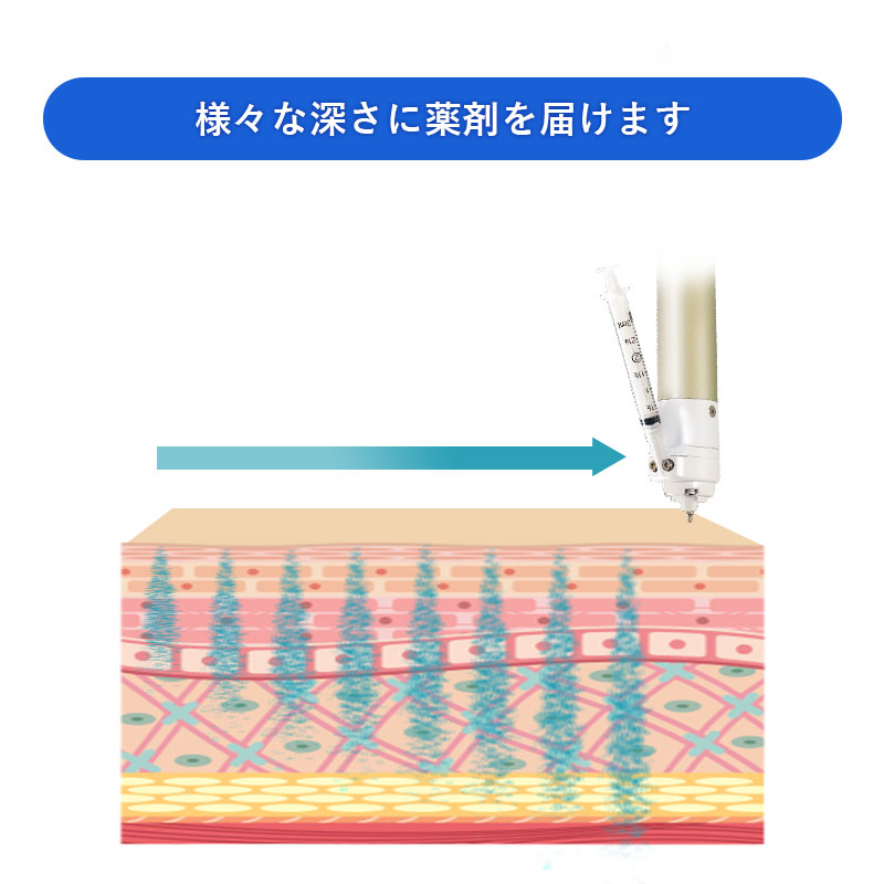 様々な深さに薬剤を届けます