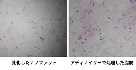乳化した細胞とアディナイザーで細断した細胞の比較