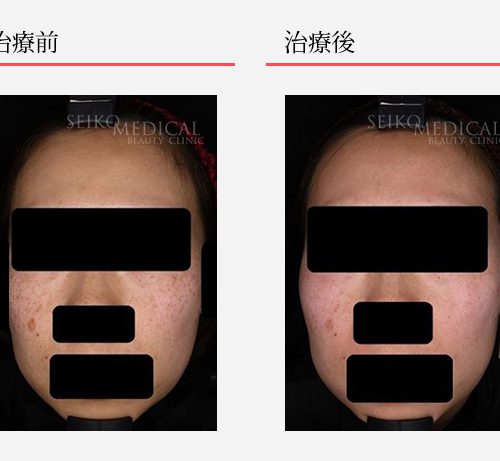 ♡nacha♡ ゼオスキンヘルス3点セット ゼオスキンヘルス②セラピュー