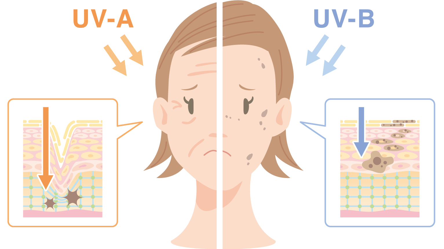 「UVB」は「シミ」の原因「UVA」は「シワ・たるみ」の原因