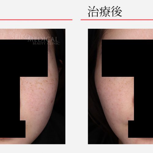 【omochi】LAVIEN セリナコラボ肌レベル爆上げセット ドクターシーラボ® SHOGO SEKINE氏とのコラボレーション